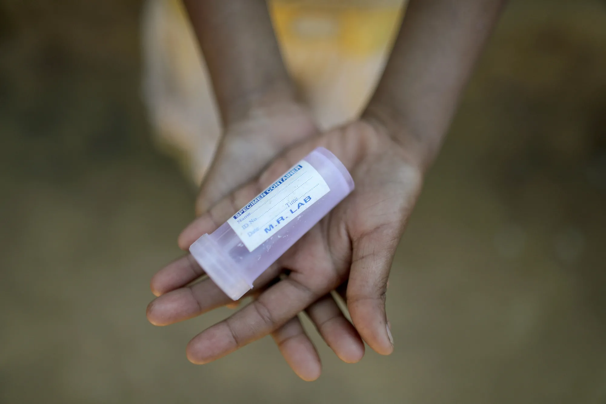 Rokhaida, 8, carrega um recipiente médico vazio. No campo em Bangladesh, muitos dos refugiados Rohingya estão doentes e precisam desesperadamente de serviços médicos.