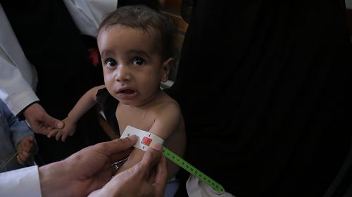 CARE, Iêmen: uma solução política é a única maneira de evitar a fome