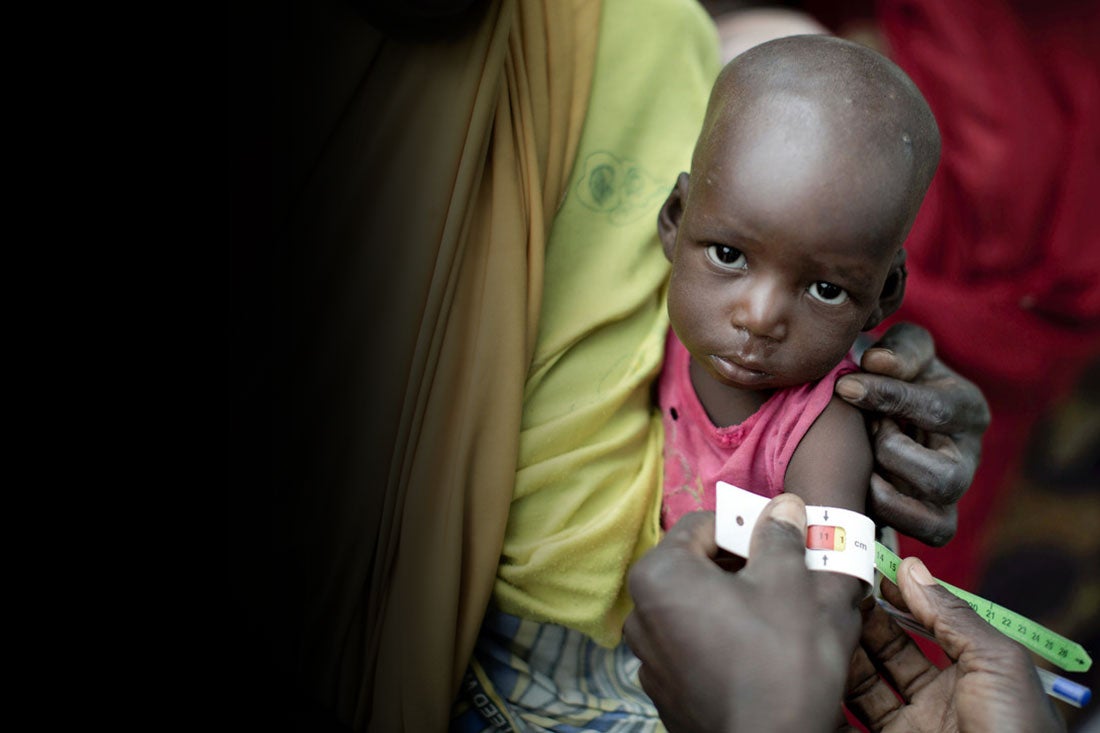 A young child looks at the camera while a healthcare worker measures their arm circumference using a malnutrition armband.