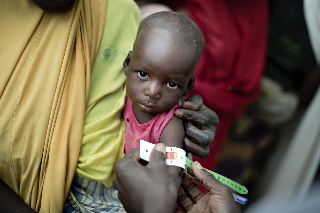 A young child looks at the camera while a healthcare worker measures their arm circumference using a malnutrition armband.