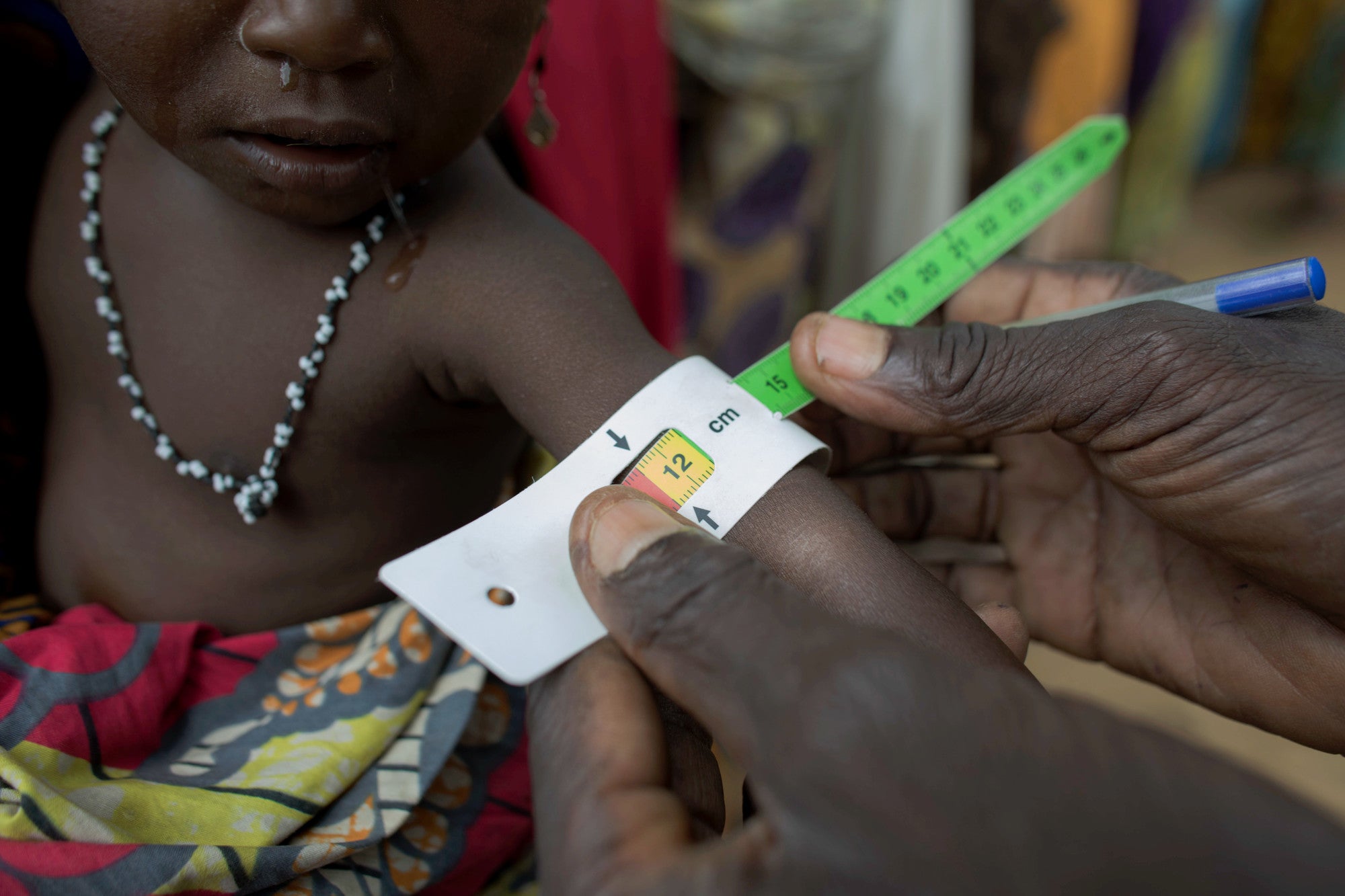 Detail of a arm band used to measure child malnutrition