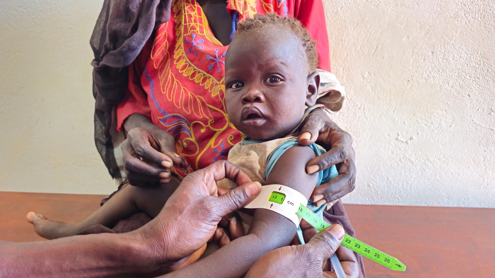 A close-up image shows a small Sudanese child sitting on an adult's lap while a medical worker measures the child's upper arm circumference with a green and white MUAC (Mid-Upper Arm Circumference) tape to screen for malnutrition.