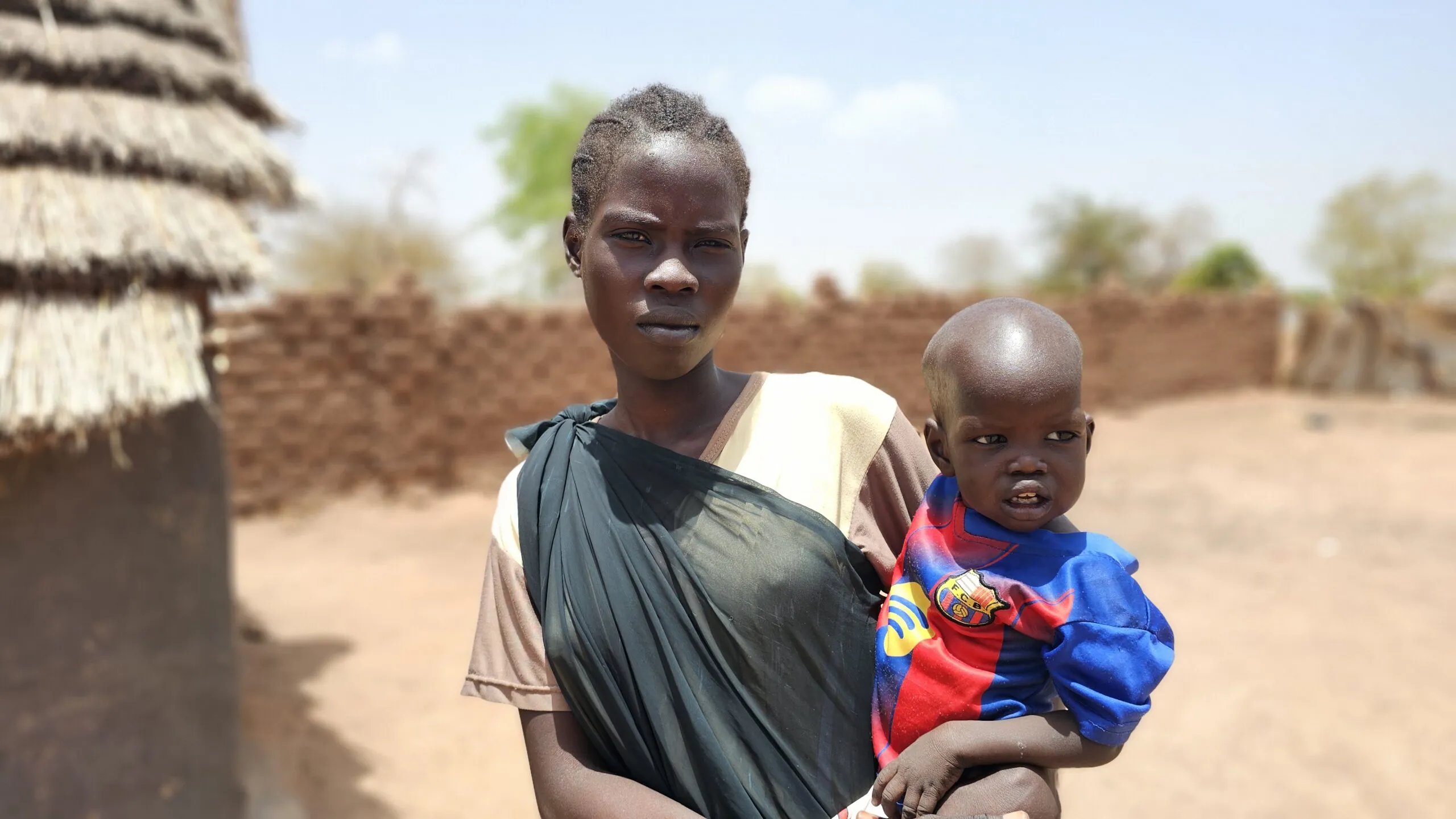 A mother holds her young child as the child receives medical care in South Sudan.